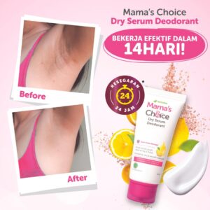 testimoni deodoran cara memutihkan ketiak