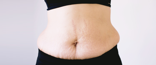 corset คอร์เซต คอร์เซ็ท คอร์เซ็ต ผ้ารัดหน้าท้องหลังคลอด เข็มขัดรัดหน้าท้องหลังคลอด