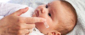How to deal with baby skin peeling