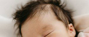 How To Prevent Baby Hair Loss in 7 Ways