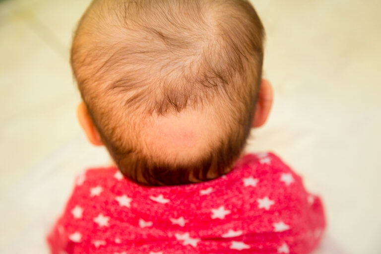 How To Prevent Baby Hair Loss in 7 Ways