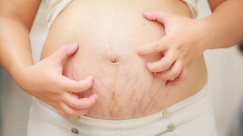 Itchy skin during pregnancy