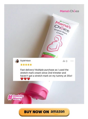 best-stretch-mark-cream-amazon