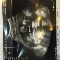 Blanche Fortes profile icon