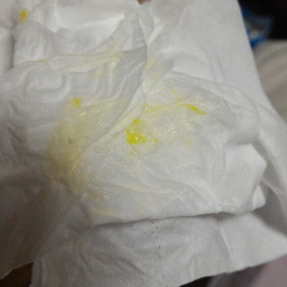 My fully latched on 11 weeks old baby vomit yellow kind of
