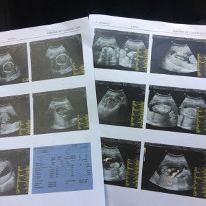 Vongvan Waan profile icon