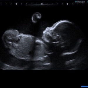 Katie Boon profile icon