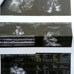 Bsit DanCel profile icon