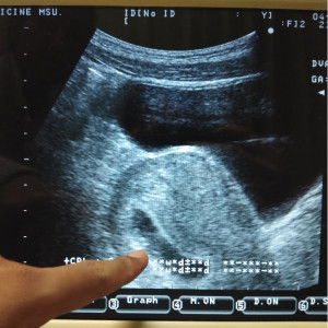 Pongjit Triamreang profile icon