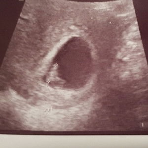 Zafyrah Zaid profile icon