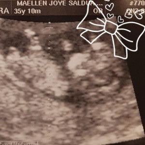 Jerlynne Baviera profile icon