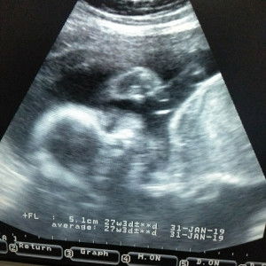 อ้อม A profile icon