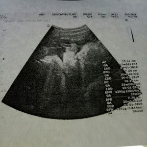 เอมอร เลขงู profile icon