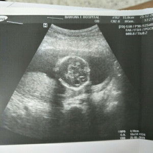 Kanchana Masuriya profile icon