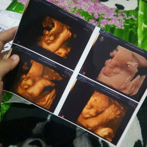 Ayuu Laarasati profile icon