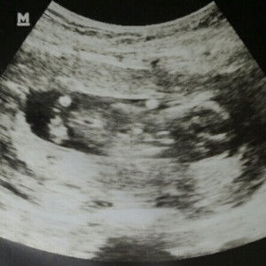 Isay Disonglo profile icon