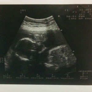 Akira Sasaki profile icon