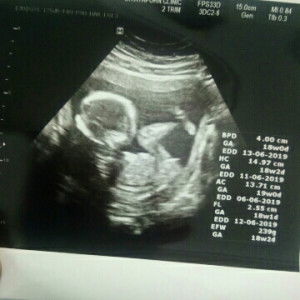 Puper Artthitaya profile icon