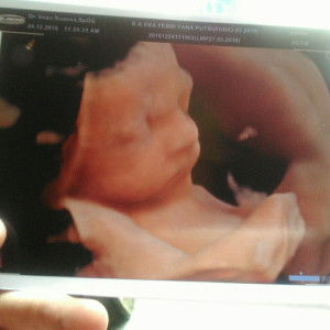 Dhimazz Ady Surya profile icon