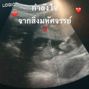 Sunanta Channun profile icon