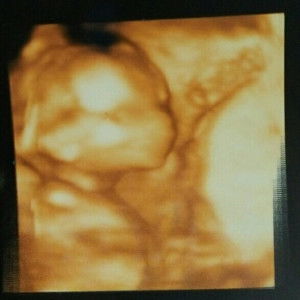 Babyboy Abinda profile icon