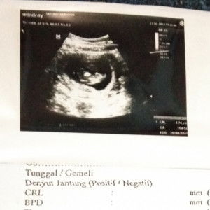 Lia Saumalia profile icon