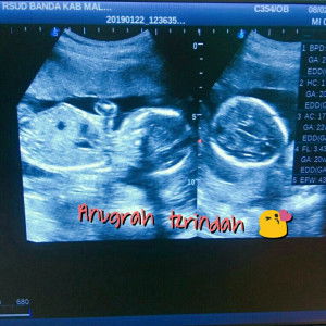 Kurnia Setiyawati profile icon