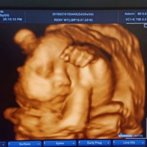 Rheny zakiyah profile icon