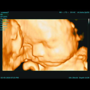 Athien Fadhilah profile icon