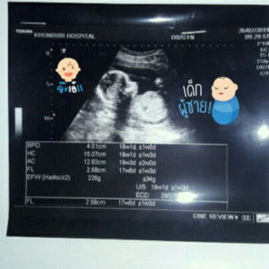 อัน ไอซ์ profile icon