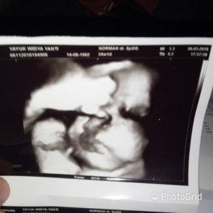 Widiyayanti profile icon