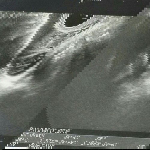 คุณสามีอยากมีน้อง