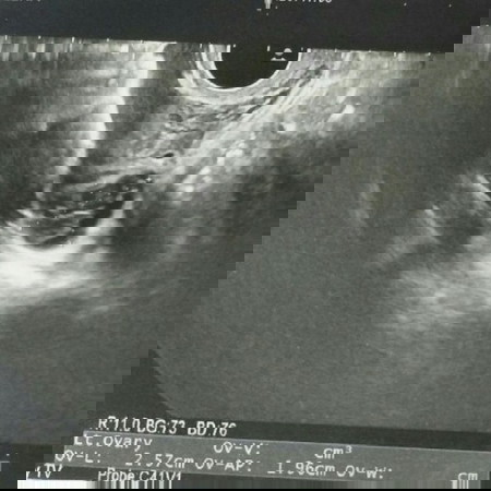 คุณสามีอยากมีน้อง