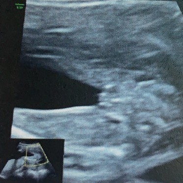 แม่ๆช่วยดูเพศหน่อยได้ไหมคะ