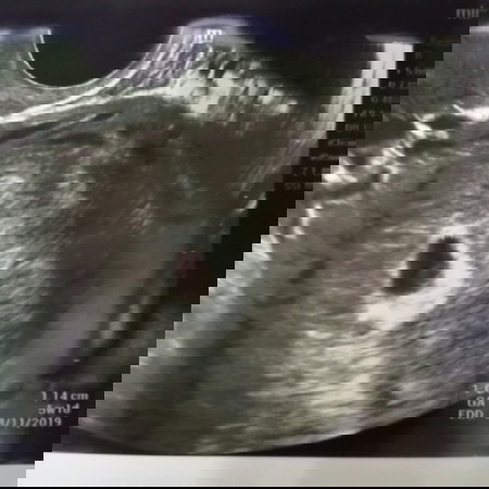 เพื่อชีวิตน้อยๆ