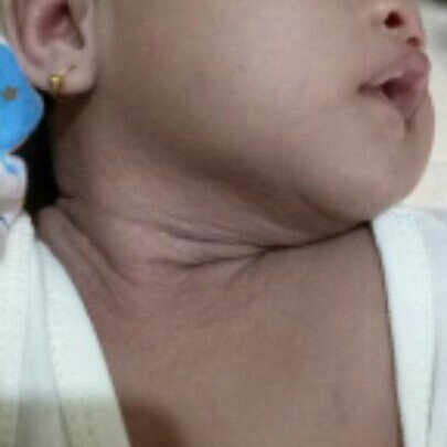 biang keringat