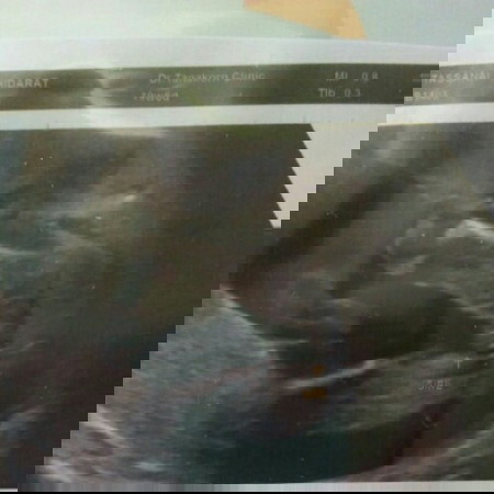 เรื่องเพศจร้า