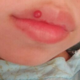 kehamilan trimester 2.