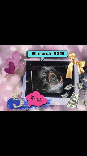 ท้อง5 Week