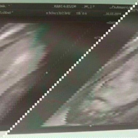 ท้องแรกจ้าไม่มีประสบการณ์ขอคำแนะนำน่อย