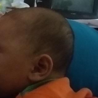 rambut bayi susah tumbuh
