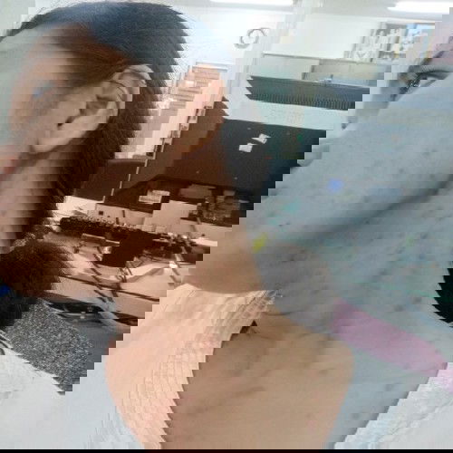 ผื่นขึ้น..ไตรมาสที่3 คุณแม่ท่านใดเป็นแบบนี้บ้างค่ะ...