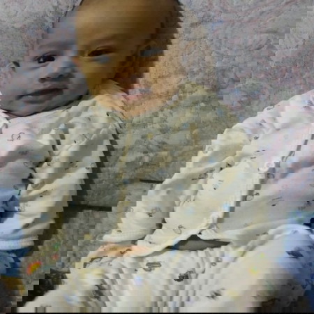 jaundice baby more than 1mnth?petanda?