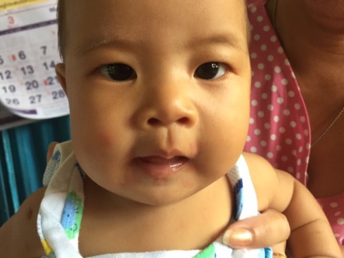 ฉีดยาได้2วัน วันนี้ปากน้องเป็นสีแดงๆ ไม่รุ้เป็นอะไร??ค่ะ