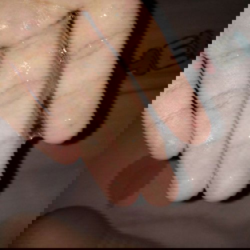 แบบนี้เรียกว่ามูกใส หรือ น้ำคร่ำรั่ว