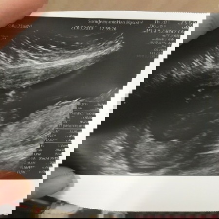 อยากทราบเพศของลูก