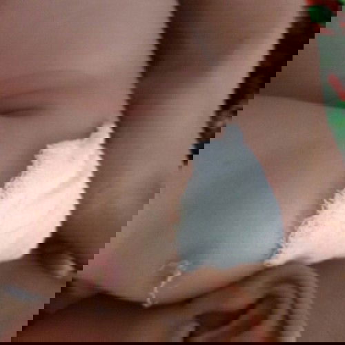 setelah bcg keluar seperti bisul