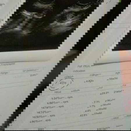 kehamilan per1 ku ??