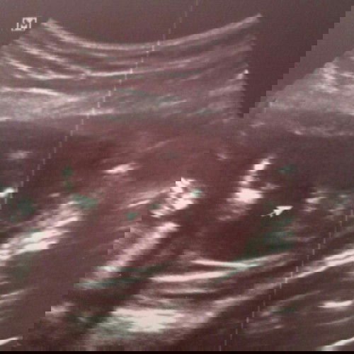 แชร์รูปที่แม่ๆไปซาวเพศลูก กันหน่อยคะ