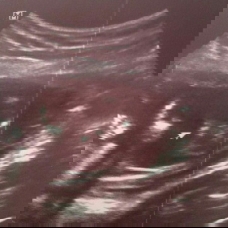 แชร์รูปที่แม่ๆไปซาวเพศลูก กันหน่อยคะ